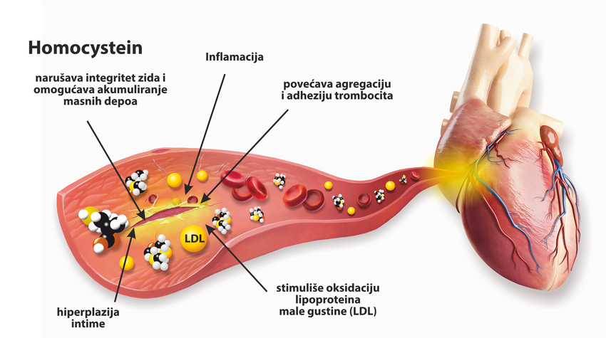 Homocistein CARDIOvitamin